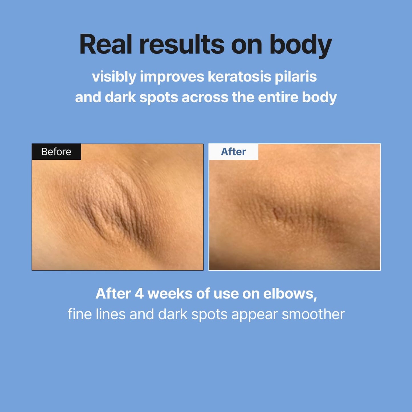 MEDITHERAPY Retinal Skin Booster Serum | Retinaldehyde, Niacinamide Anti-Aging Serum - K-Beauty Facial Serum for Fine Lines, Firming & Radiance | Hydrating Face Serum All Skin Types, 5.07 fl oz